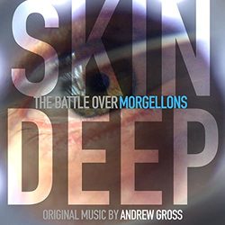 Skin Deep: The Battle Over Morgellons