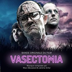 Vasectomia