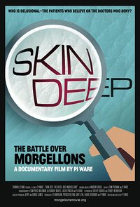 Skin Deep: The Battle Over Morgellons 