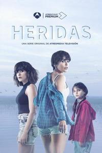 Heridas